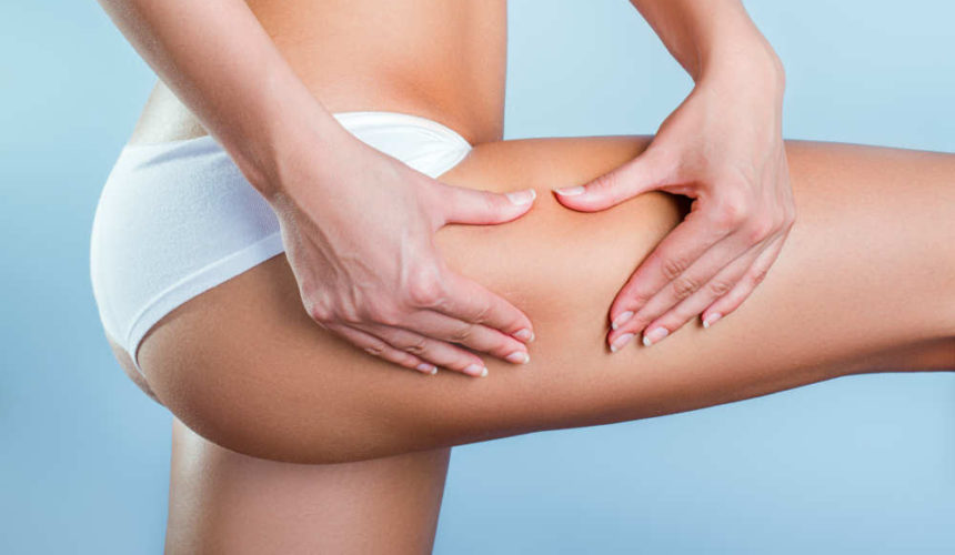 Which aesthetic treatments are the most popular for treating cellulite? Which aesthetic treatments are the most popular for treating cellulite?