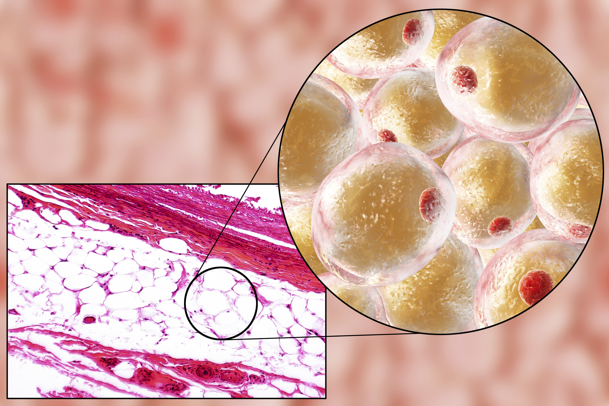 Липоциты. Адипоциты гистология. Белая жировая ткань адипоциты. Жировая ткань микрофотография. Липоциты в жировой ткани.