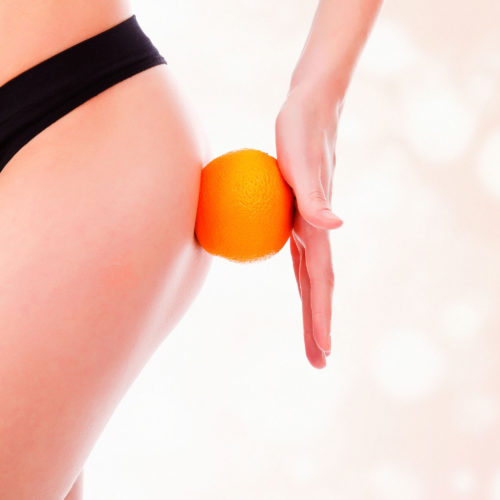 Top cellulite treatments