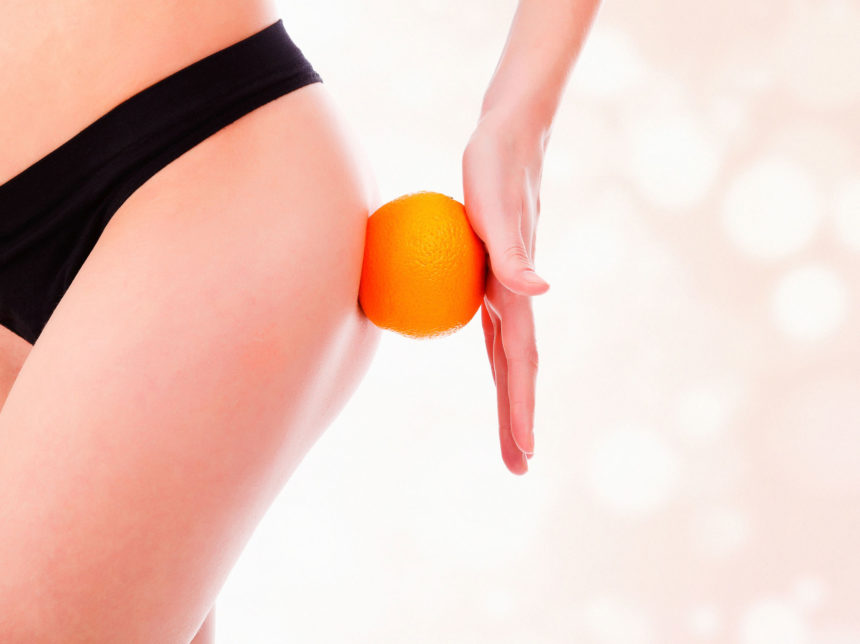 Top cellulite treatments