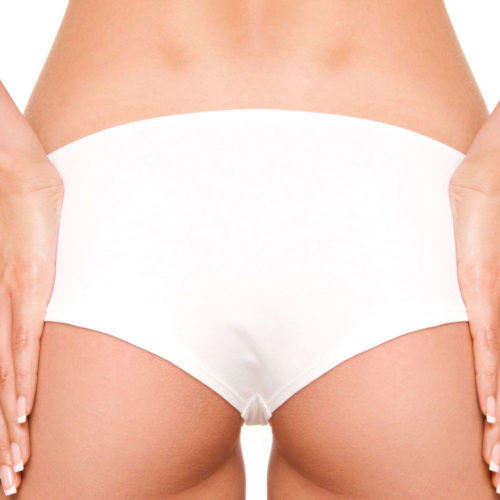 What causes cellulite on buttocks?